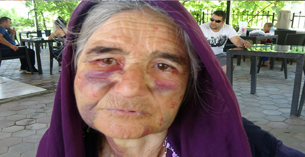 SÜRÜYE KARIŞAN KUZUSUNU ALMAK İSTEYEN YAŞLI KADIN DARBEDİLDİ