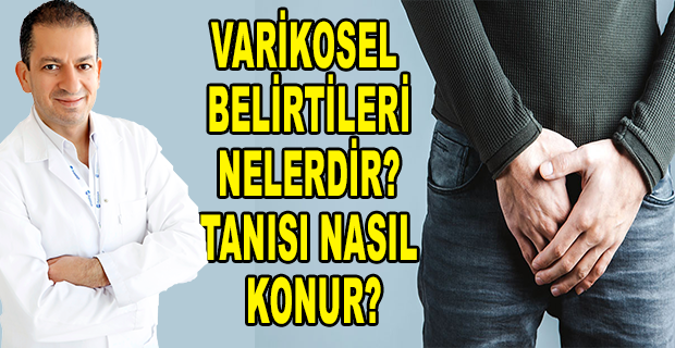 VARİKOSEL NEDİR?
