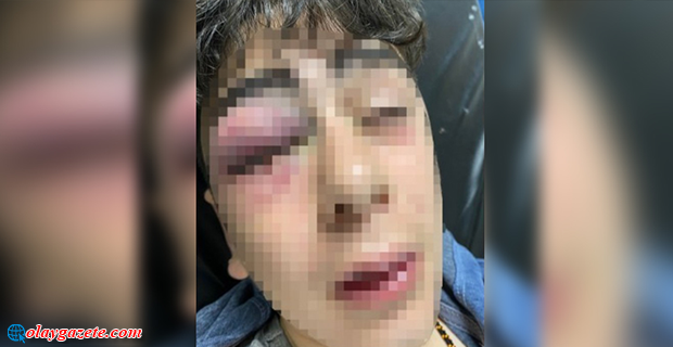 DİYARBAKIR VALİLİĞİ, LİCE’DE BİR ÇOCUĞA İŞKENCE YAPTIKLARI İDDİA EDİLEN 5 POLİSİN GÖZALTINA ALINDIĞINI VE GÖREVDEN UZAKLAŞTIRILDIĞINI AÇIKLADI