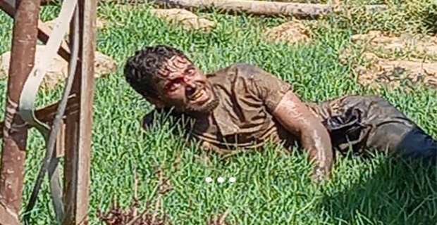  KUDUZ HASTASI HASTANEDEN KAÇTI, VATANDAŞLAR PANİKLEDİ