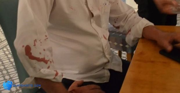 CHP’Lİ BELEDİYE BAŞKANINA BEYZBOL SOPALI SALDIRI