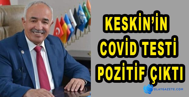 DÖRTYOL BELEDİYE BAŞKANI KESKİN