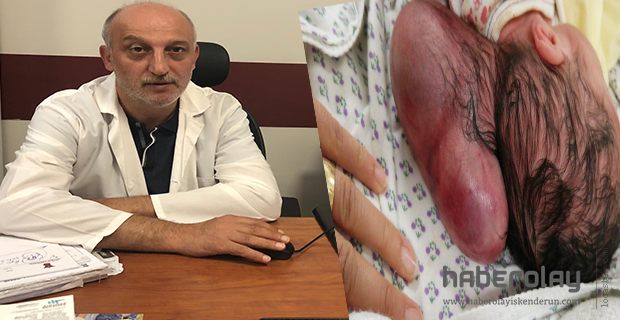 İKİ KAFALI DÜNYAYA GELEN BEBEK HAYATA TUTUNDU
