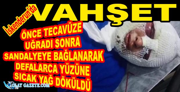 İSKENDERUN’DA BİR KADIN ESKİ SEVGİLİSİ TARAFINDAN TECACÜZ EDİLEREK İŞKENCEYE UĞRADI