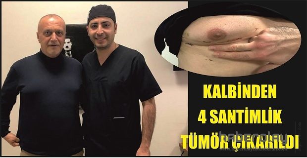 KALBİNDEN 4 SANTİMLİK TÜMÖR ÇIKARILDI