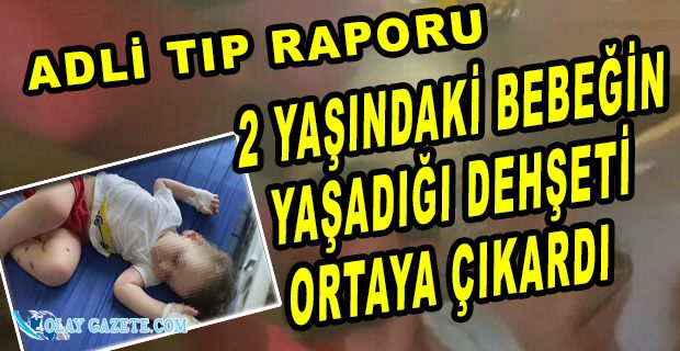 SURİYELİ BABADAN 2 YAŞINDAKİ ÇOCUĞUNA DEHŞET... ADLİ TIP RAPORU ORTAYA ÇIKTI